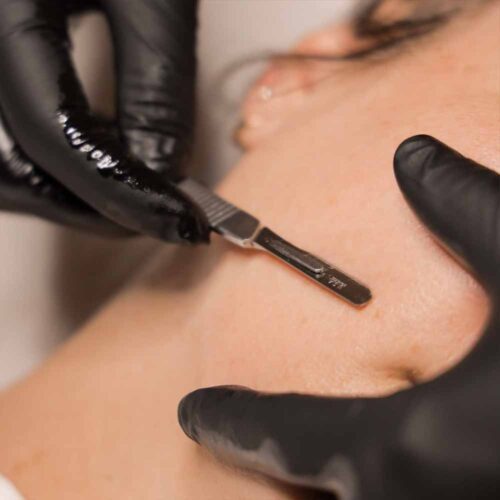 Dermaplaning spa en Córdoba